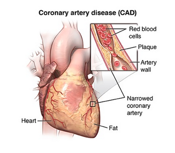 اکوکاردیوگرام سلامت قلب را چگونه تشخیص میدهد؟